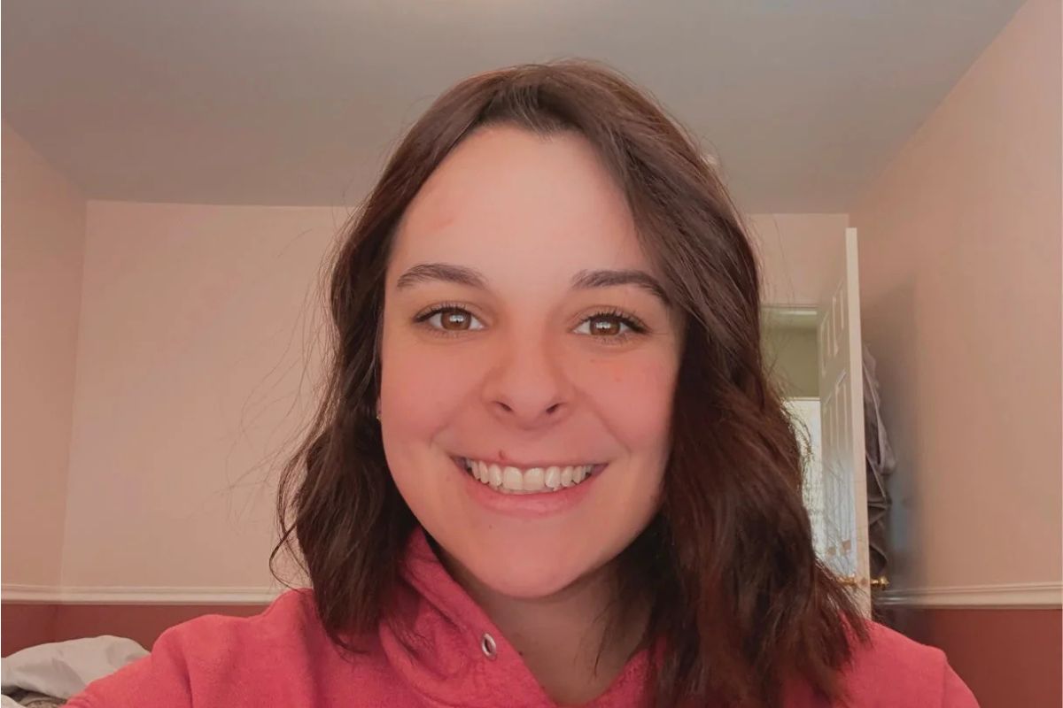Amanda's Hair Loss Journey