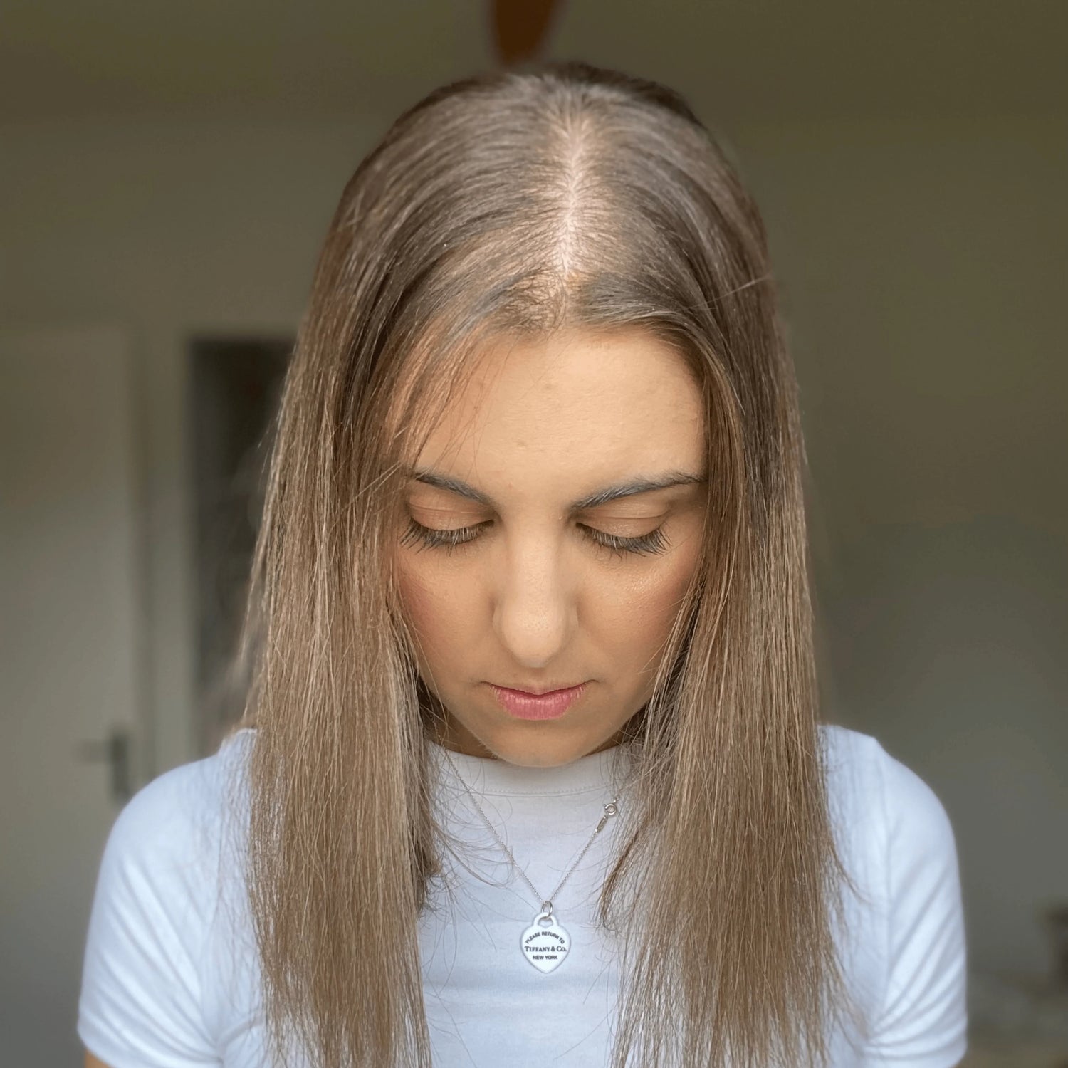 8 Causes for Female Hair Loss