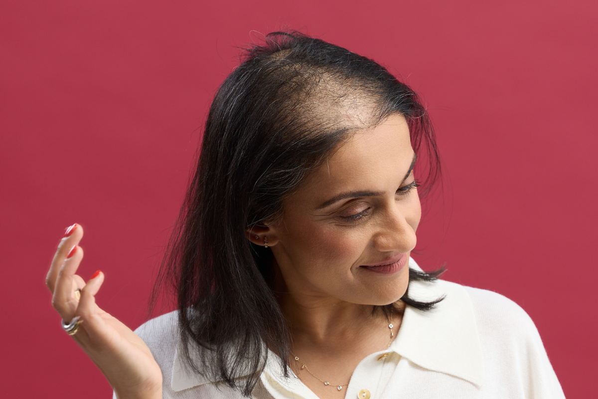 Female Hair Loss in Your 40's