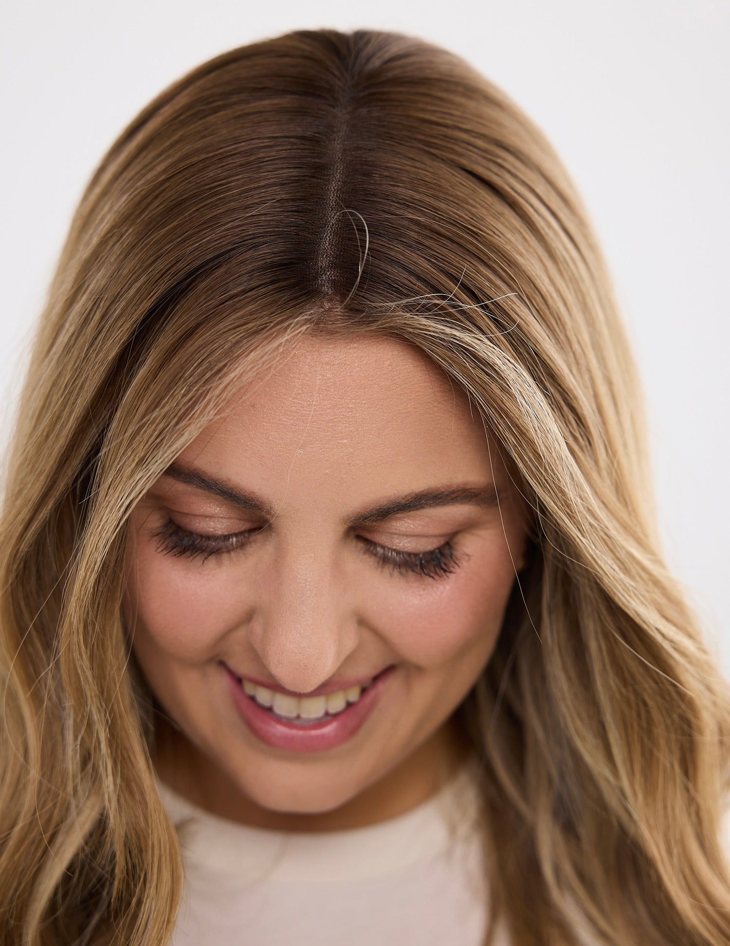 What is traction alopecia?