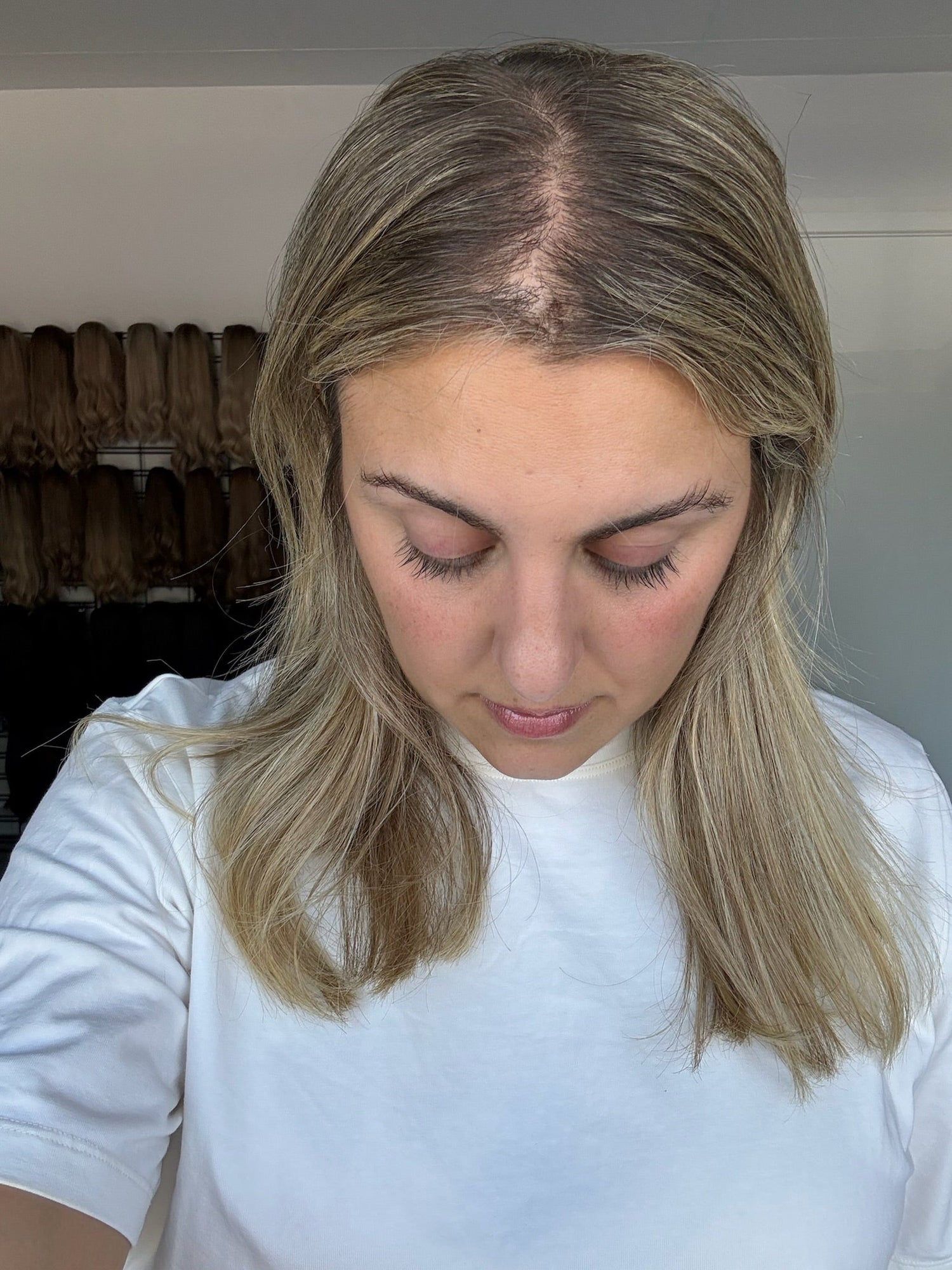 External Factors Which Cause Hair Loss