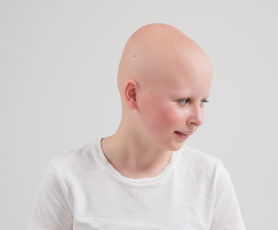 Can Hair Loss Be a Sign of Something More Serious?