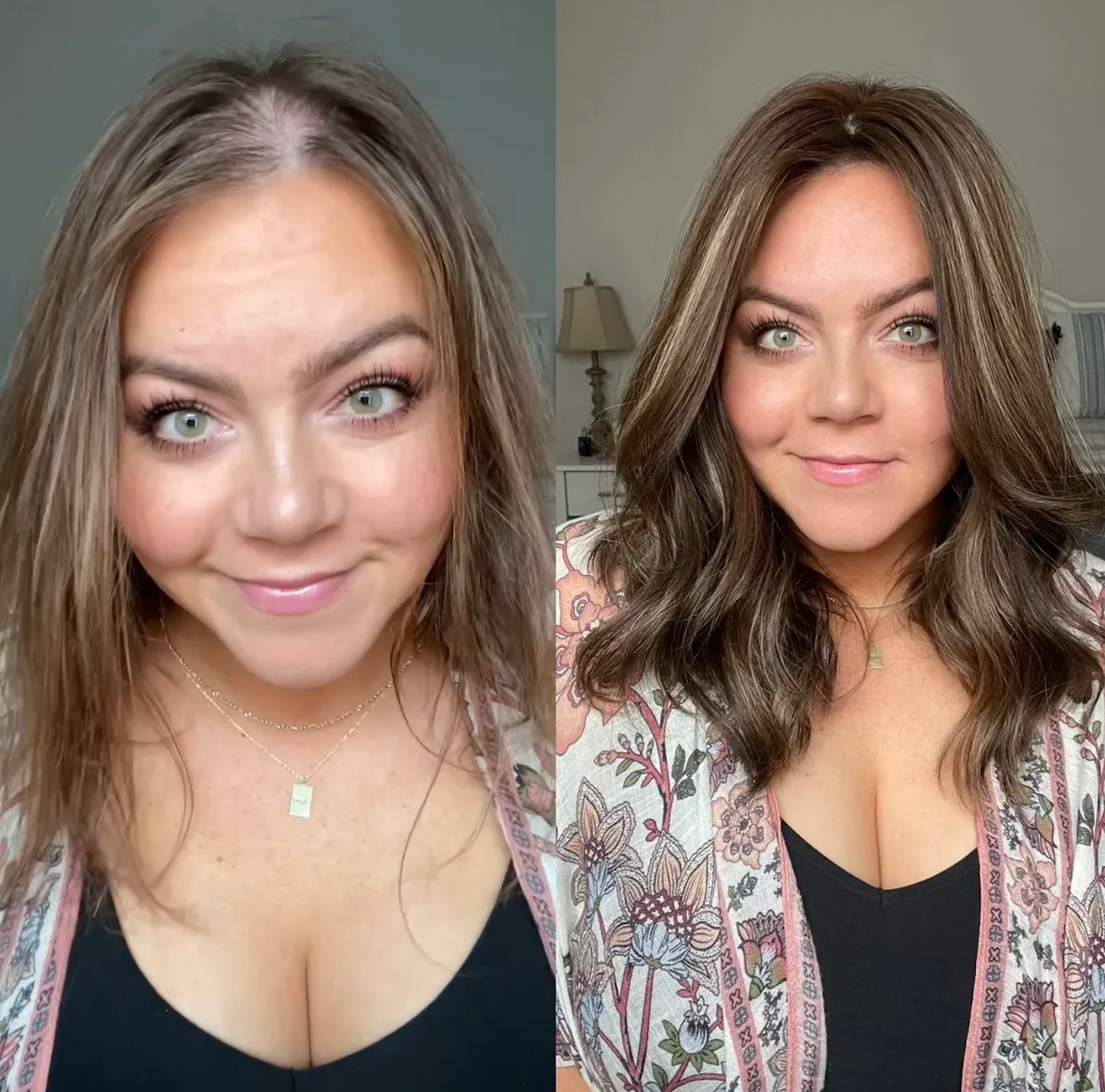 8 Hair Loss and Alopecia Influencers You Need to Be Following