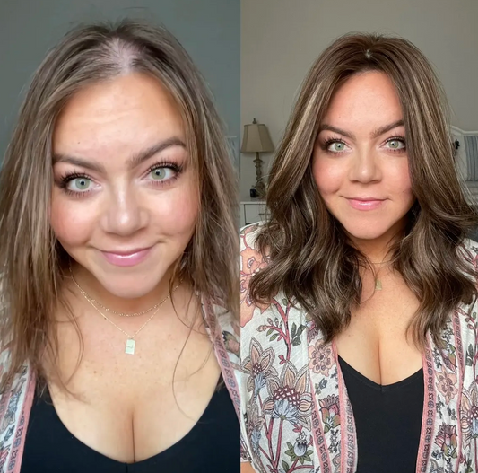 8 Hair Loss and Alopecia Influencers You Need to Be Following