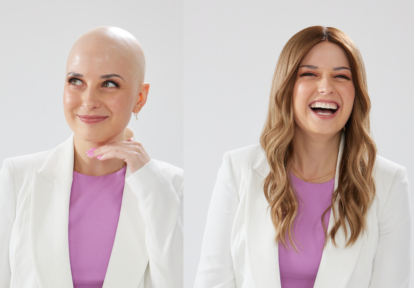 "Why Do You Wear Hair Toppers and Wigs?"