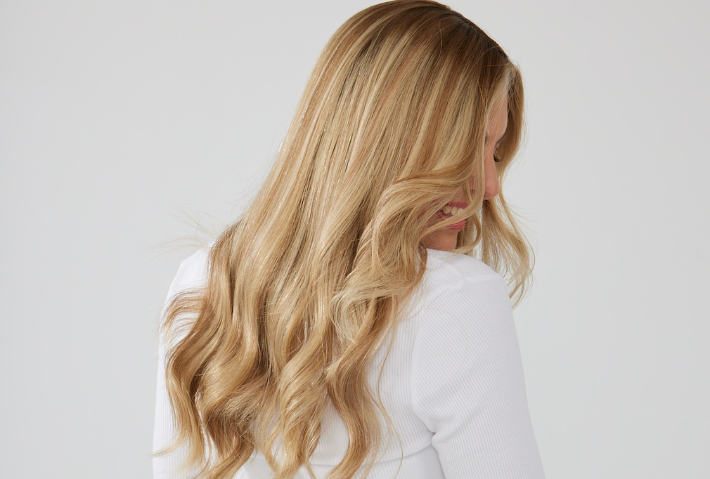 My Androgenic Alopecia Journey