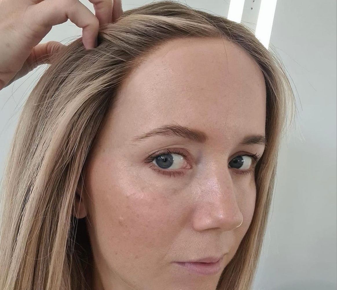 Can You Dye Human Hair Toppers?