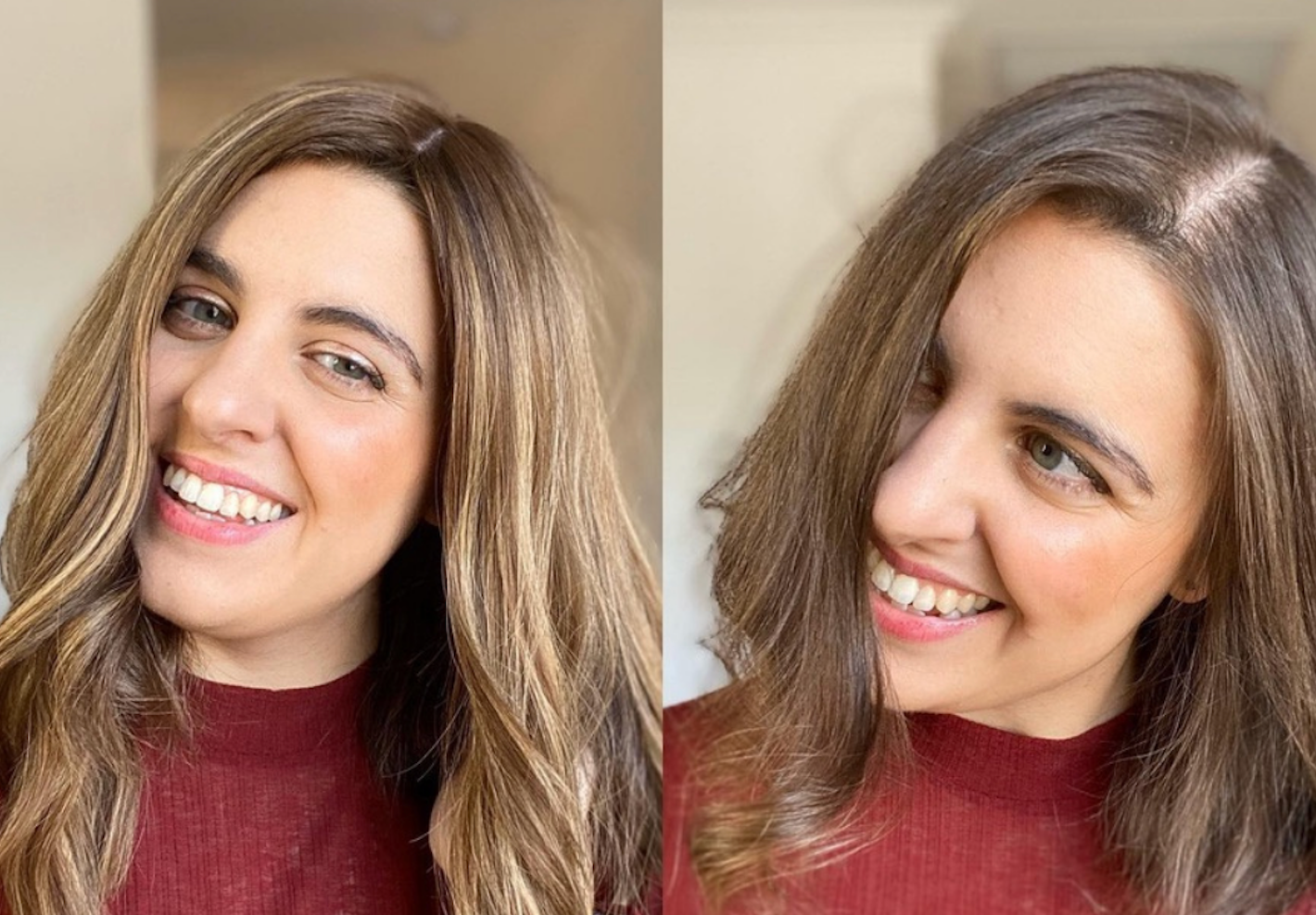 How do you stop hair loss?