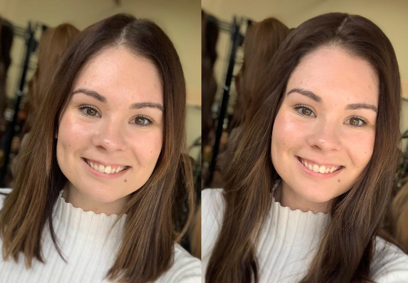 How Much Hair Loss is Normal?