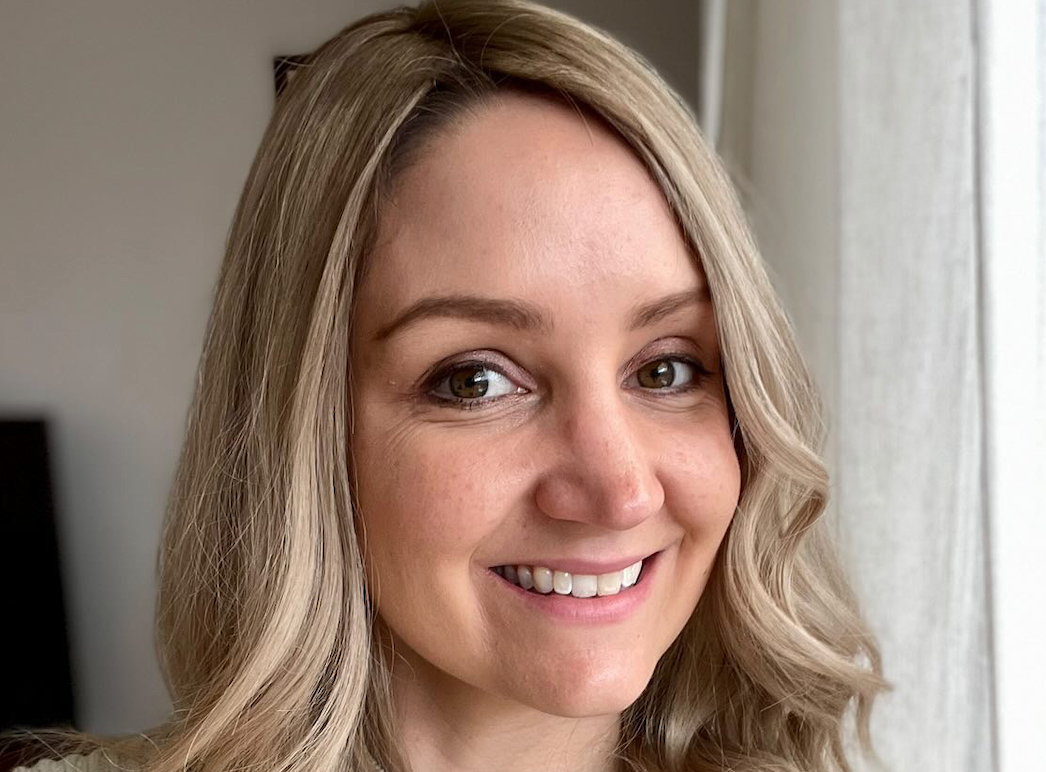 What is Seasonal Hair Loss?