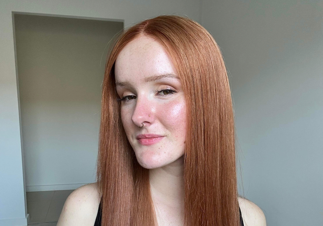 The Link Between Vitamins & Hair Loss