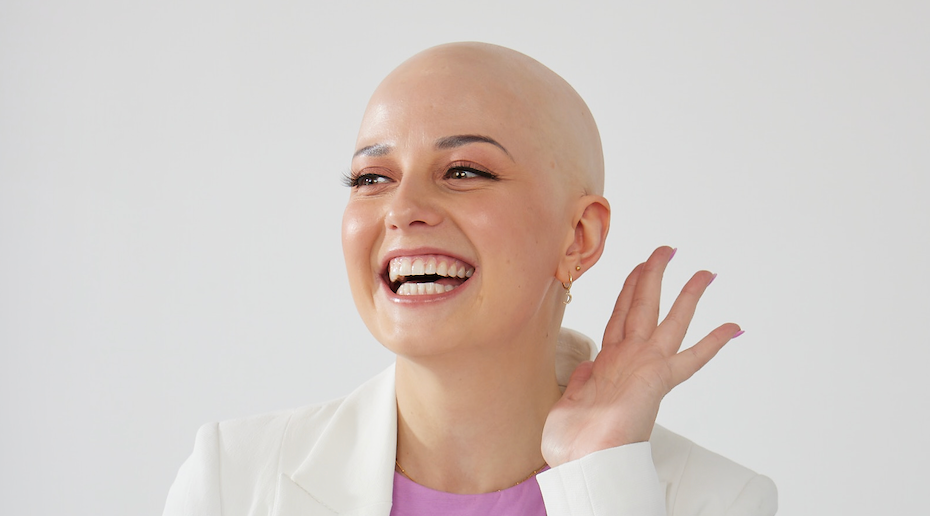 What is Alopecia?