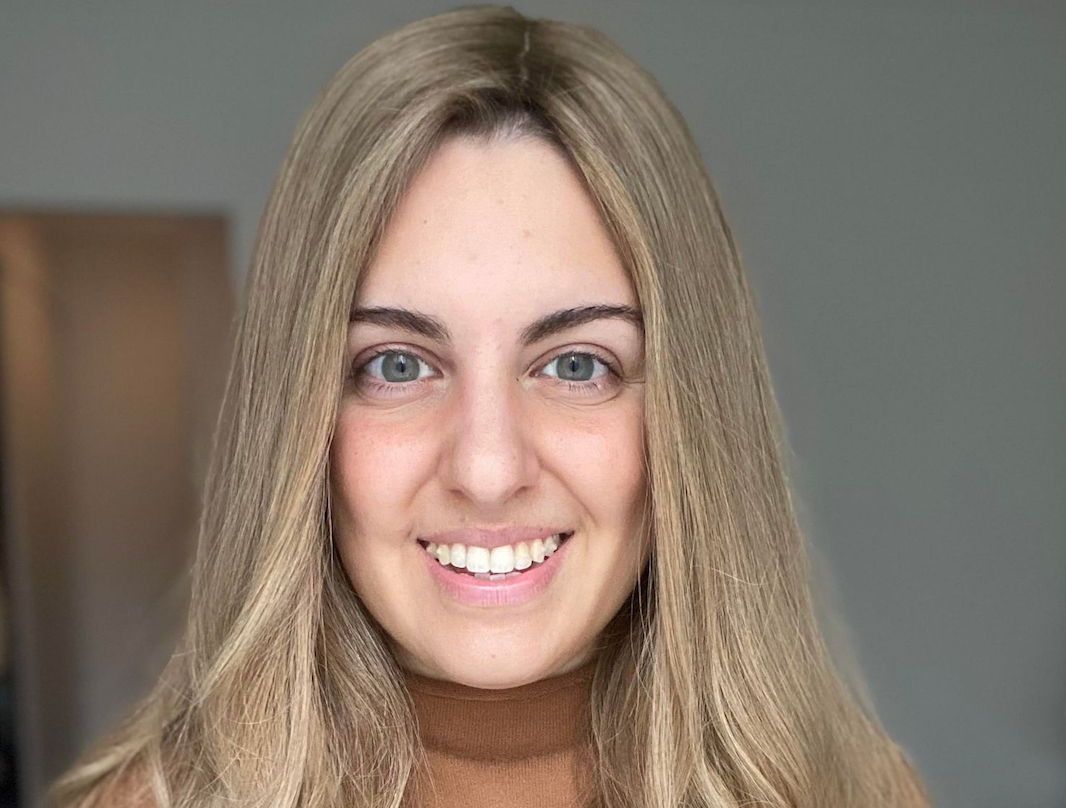 Hair Loss: An Excerpt From My Diary