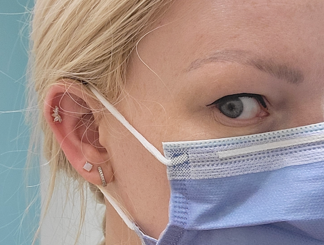 Understanding the Link Between COVID-19 and Hair Loss