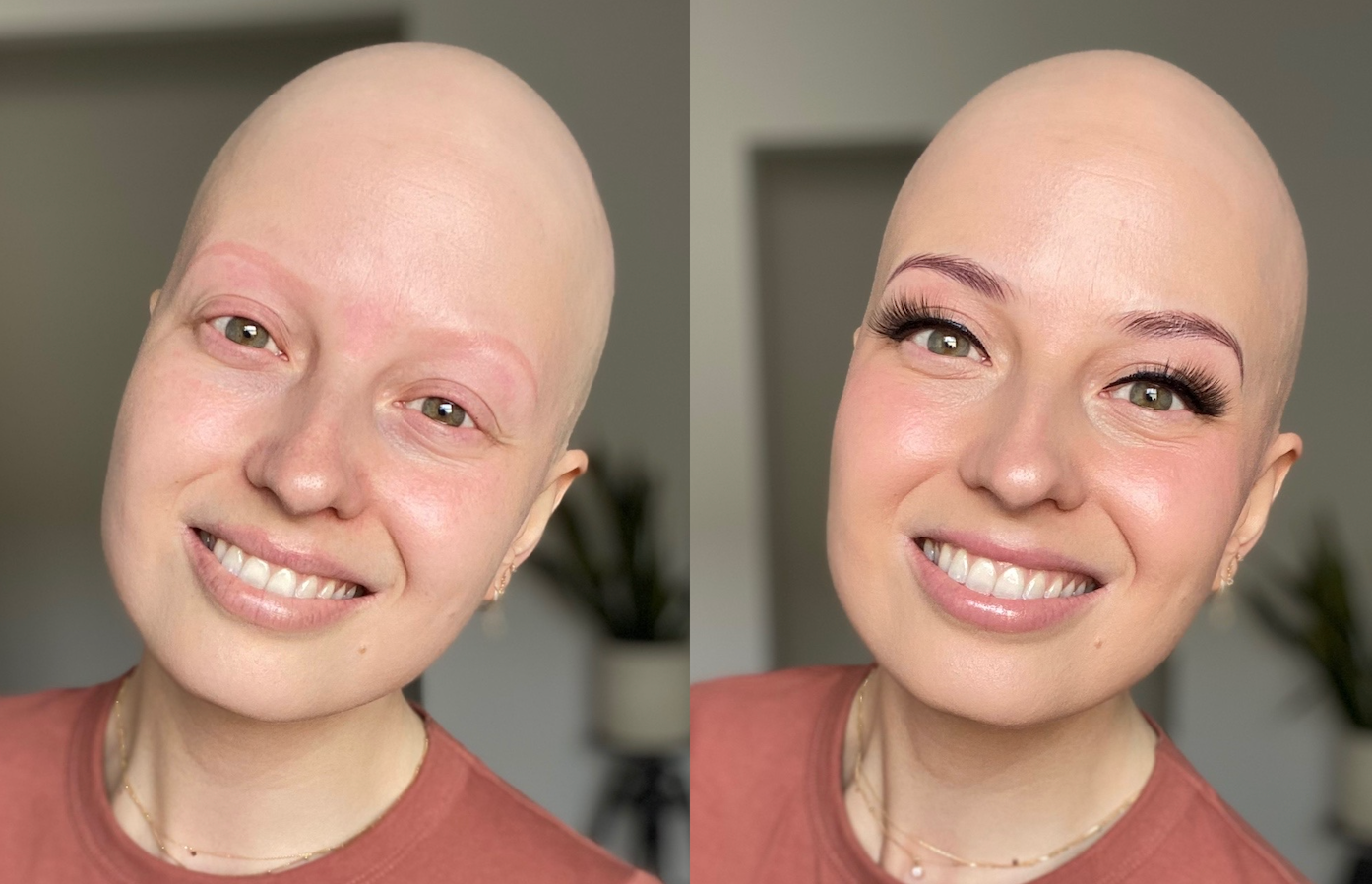 Alopecia Makeup Tips and Tricks
