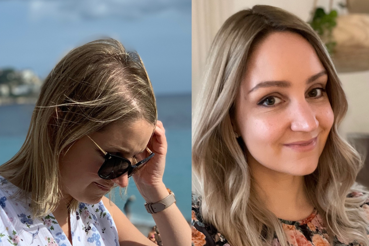 Hair Stories: Alison