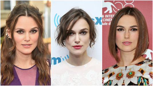 Celebrities with Hair Loss