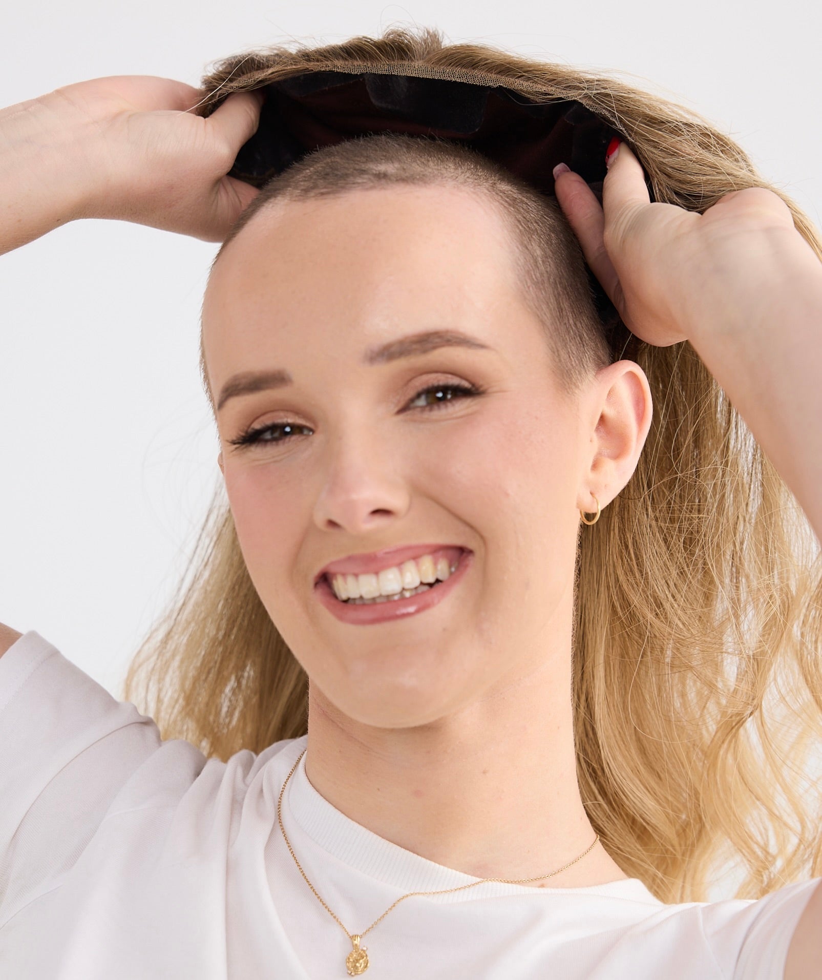 Scarring and non-scarring alopecia; what is the difference?