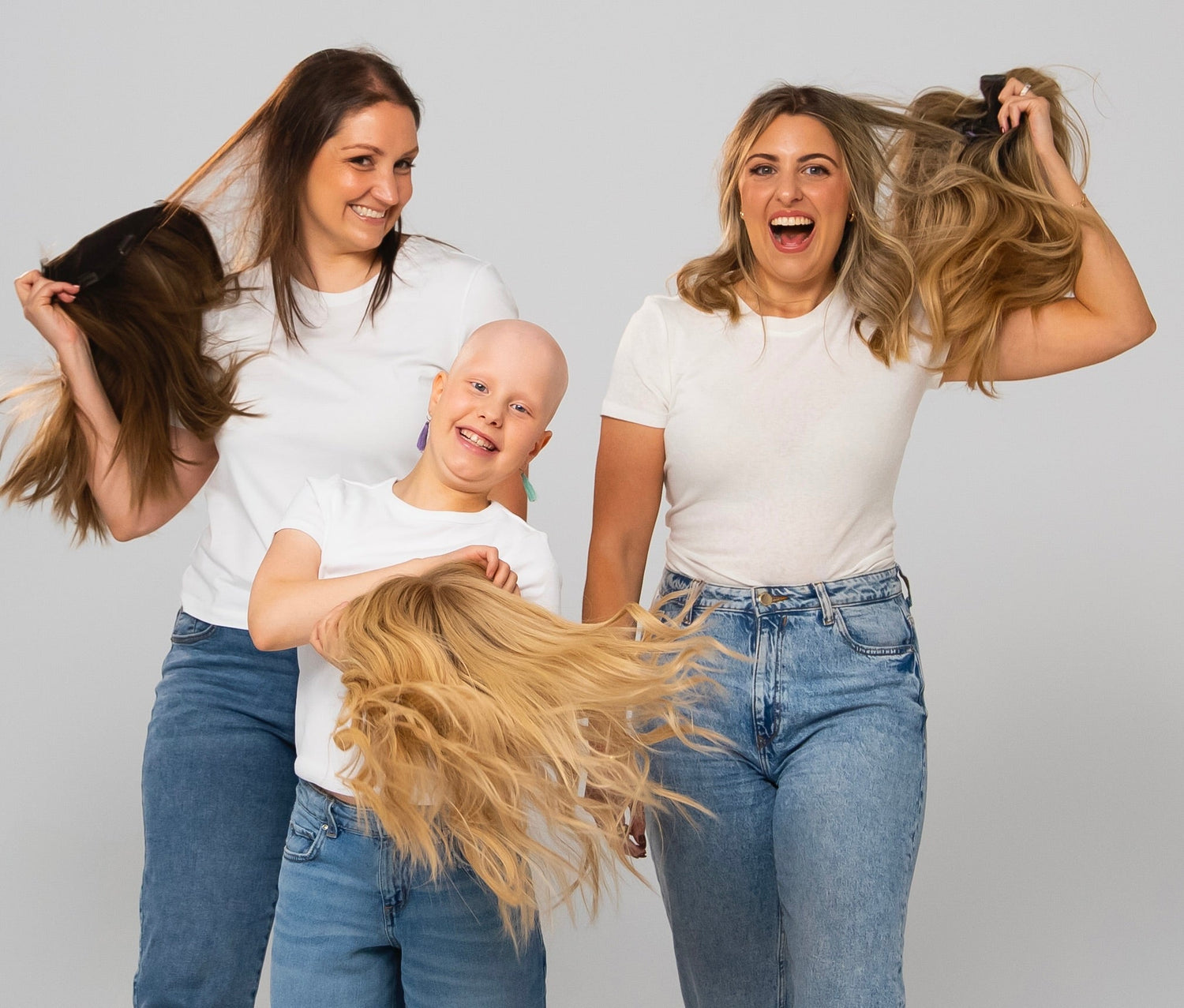 What is Alopecia?