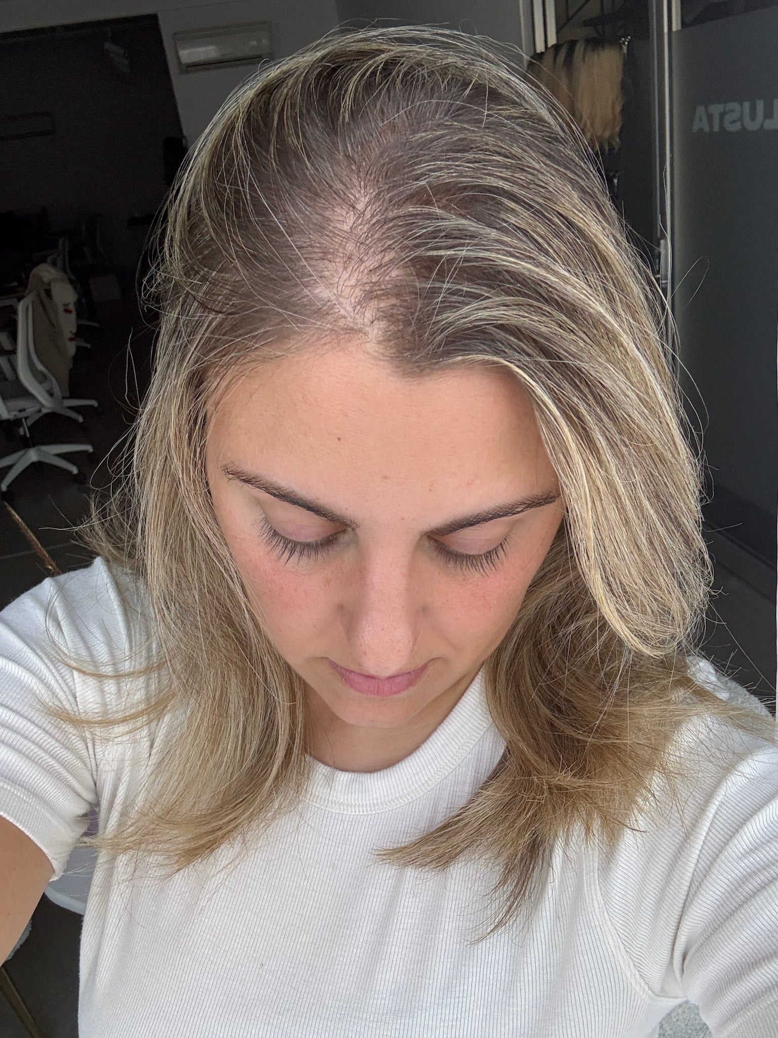 The Link Between Vitamins & Hair Loss