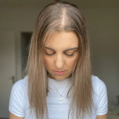 Hair Loss in Your 20's