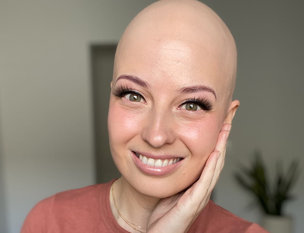 Which Vitamin Deficiencies Cause Hair Loss?