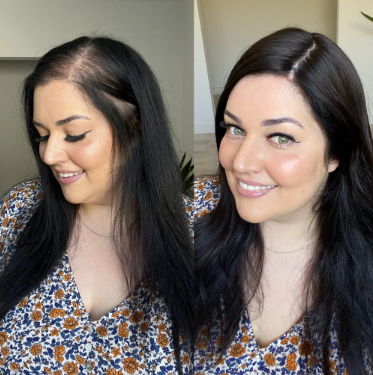 Black Human Hair Toppers | Lusta Hair