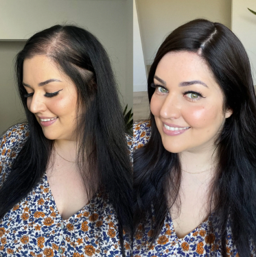 Black Human Hair Toppers