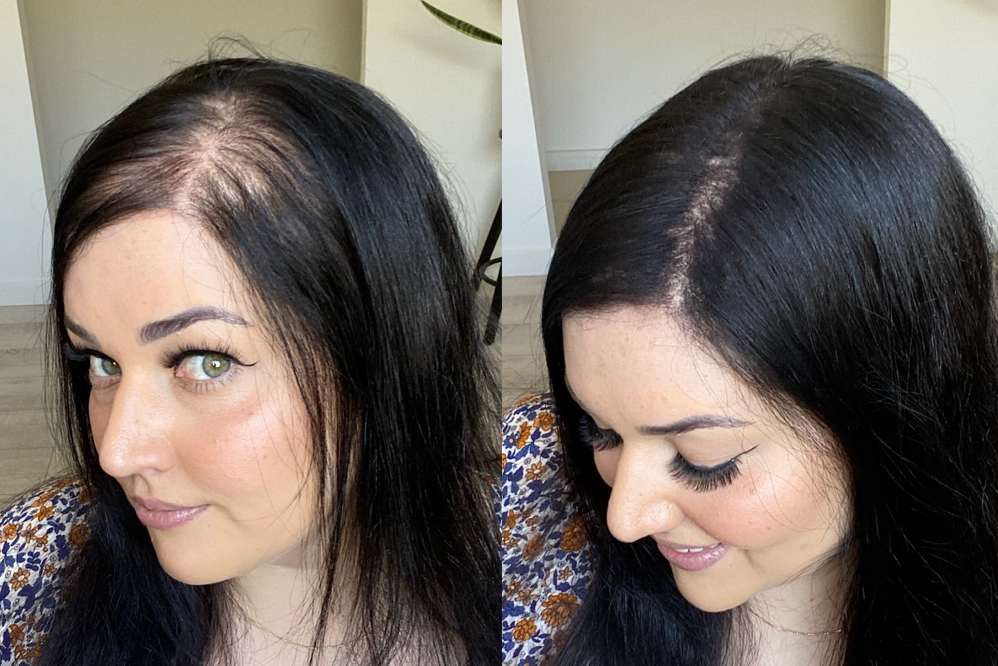 Fixing Thin Hair: Your Guide to Bouncing Back to Voluminous Locks