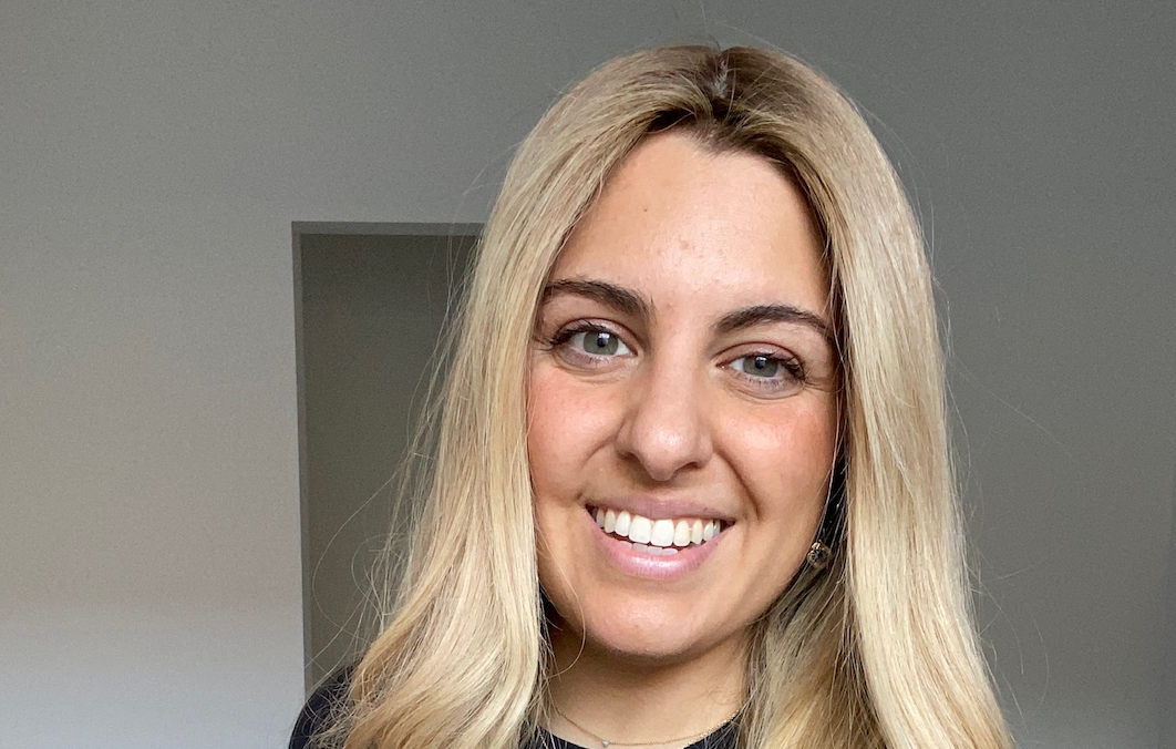 My Hair Loss Journey